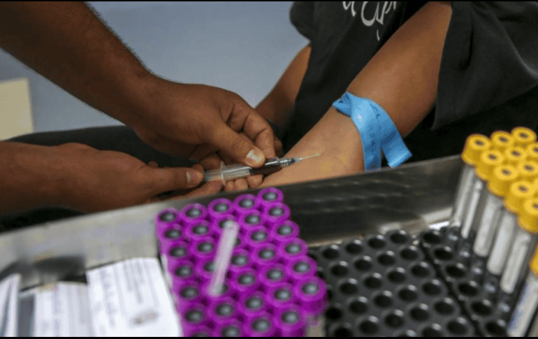 El examen de antígeno prostático específico (PSA) es una prueba de sangre que mide una proteína producida por la próstata y ayuda a detectar cáncer, hiperplasia benigna o prostatitis.CORTESÍA / HCG