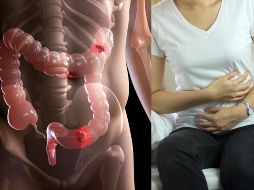 Cuando el cáncer avanza, o incluso en fases tempranas, existen otros indicadores que requieren una evaluación médica inmediata. CANVA