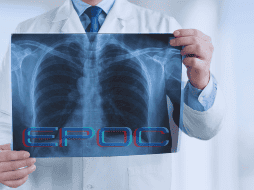 La EPOC se manifiesta principalmente en personas mayores de 40 años y hoy figura entre las principales causas de fallecimiento en México. ESPECIAL / CANVA