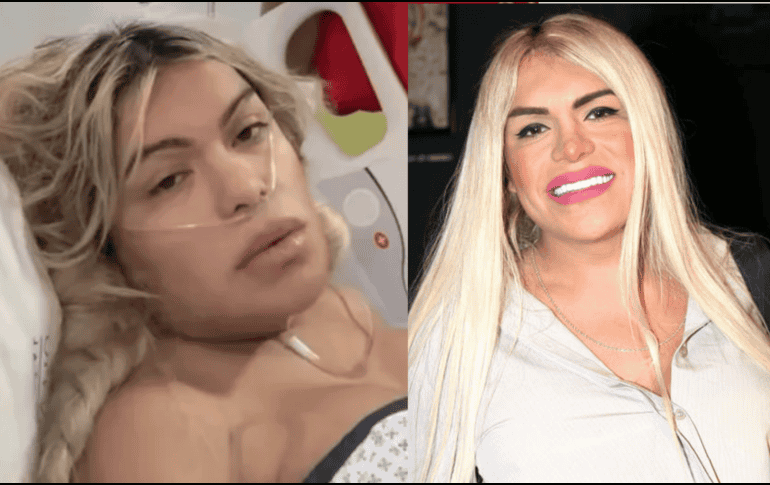 La influencer explicó que antes de cualquier procedimiento adicional se someterá a revisiones médicas estrictas para confirmar que su presión arterial se encuentre controlada y en niveles estables. INSTAGRAM/yosoywendyguevaraoficial