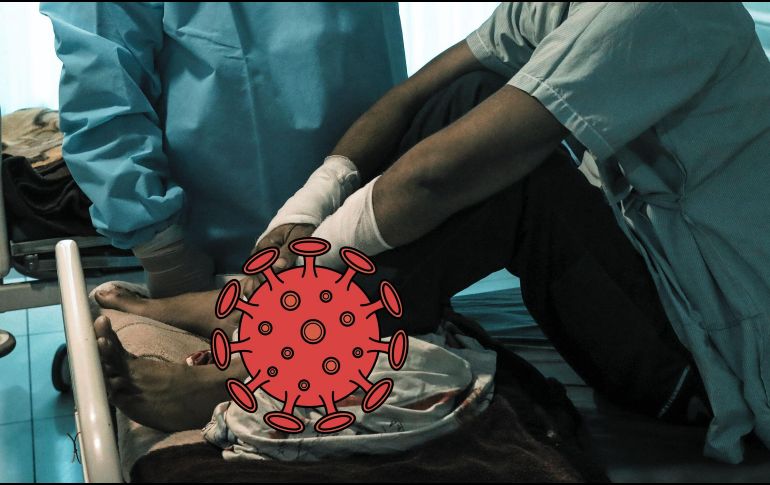 Los síntomas iniciales de la infección por el virus de Nipah son inespecíficos y esto puede dificultar el diagnóstico y crear problemas para detectar los brotes. EFE / ARCHIVO