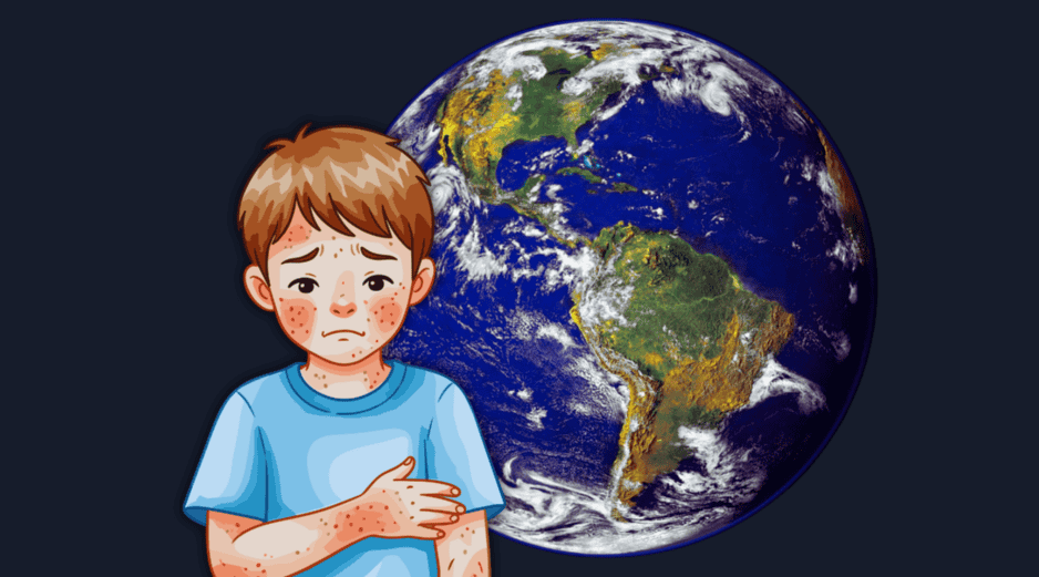 La disminución sostenida de las coberturas es el principal detonante del regreso del sarampión: ESPECIAL / CANVA