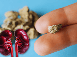 Desde luego, expulsar esas 