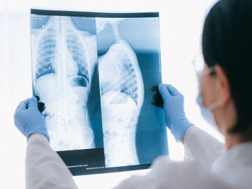 Se trata de Amivantab y Lazertinib, combinación de medicamentos ya disponible en México, que podría ser utilizado por la gran mayoría de pacientes con este tipo de cáncer como sustituto a la quimioterapia. Pexels