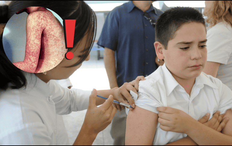 El primer brote del actual periodo se registró en Chihuahua en febrero de 2025. NTX / ARCHIVO / ESPECIAL / IMSS