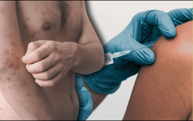 La aplicación de la vacuna contra el sarampión es segura y los efectos secundarios posteriores a su aplicación son mínimos. ESPECIAL/Canva