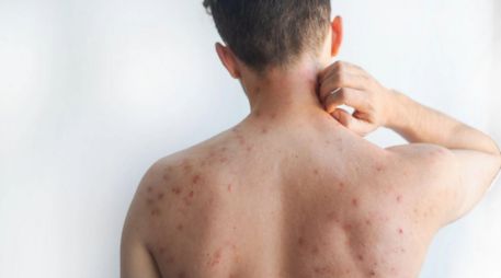 De acuerdo con la Organización Mundial de la Salud (OMS), hay algunas acciones que puedes realizar para mejorar algunos síntomas. ESPECIAL/Canva