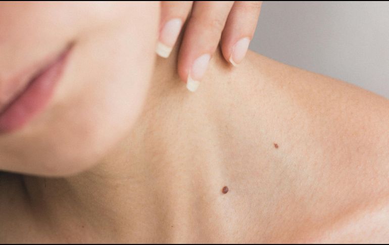 La aplicación de tratamientos naturales puede complementar la rutina de cuidado diario. A. ECHEVERRY