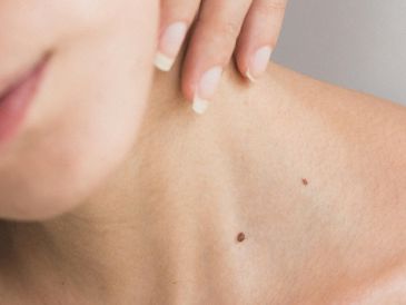 La aplicación de tratamientos naturales puede complementar la rutina de cuidado diario. A. ECHEVERRY