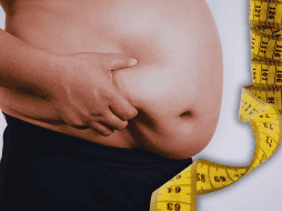 La obesidad es una enfermedad crónica generada por factores genéticos, hormonales, ambientales y conductuales, que va más allá de los hábitos alimenticios. ESPECIAL / CANVA