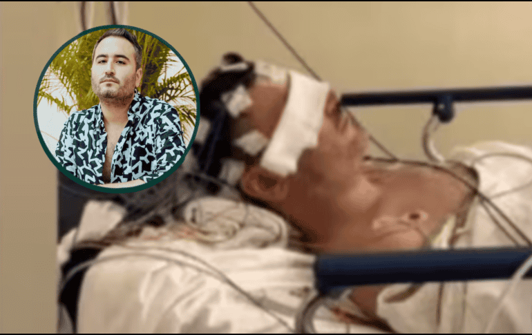 el músico aseguró que “todo se ve más grave de lo que es”, buscando reducir la preocupación que generaron las imágenes. INSTAGRAM/chuinavarro