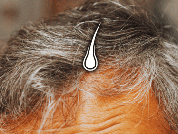 A medida que disminuye la capacidad de los melanocitos para producir melanina, el pelo empieza a volverse blanco. ESPECIAL / CANVA