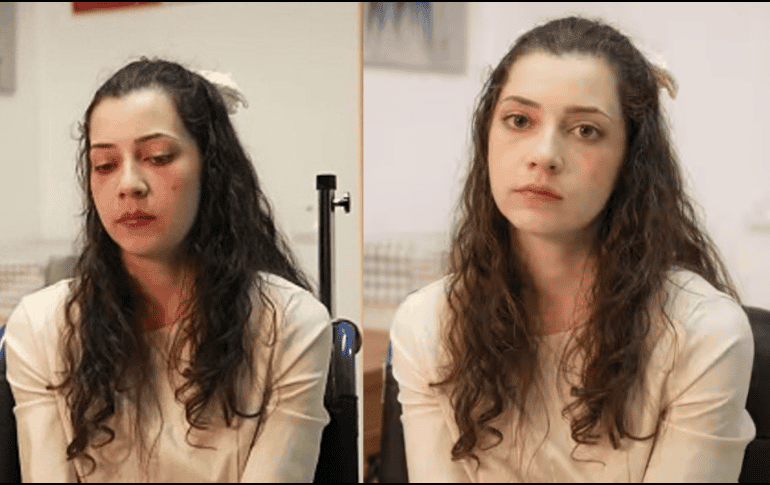 Su caso se ha desarrollado bajo el marco de la normativa estatal aplicada en Cataluña, que permite este procedimiento en circunstancias específicas. YOUTUBE/BluRadio