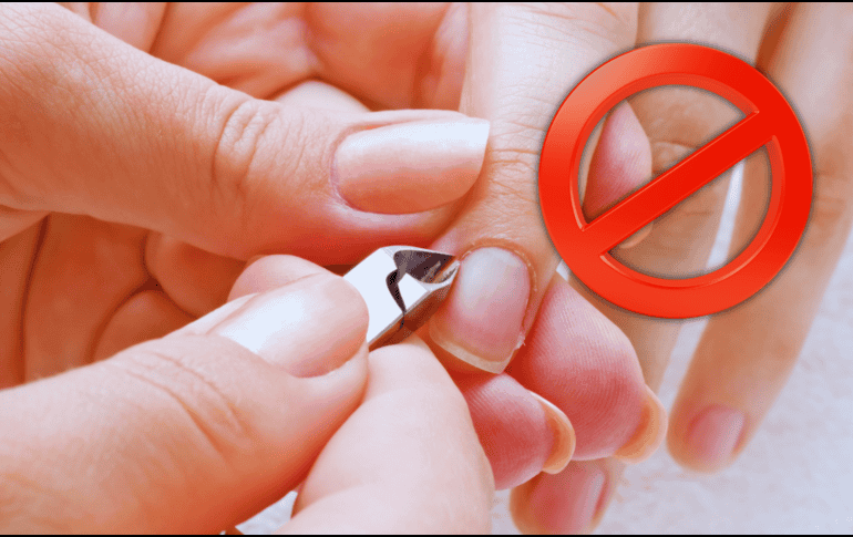 Cortar este pedazo de piel cerca de la uña puede causar daños permanentes, por ejemplo, deformidades, surcos, ondulaciones o cambios en el grosor. ESPECIAL / CANVA