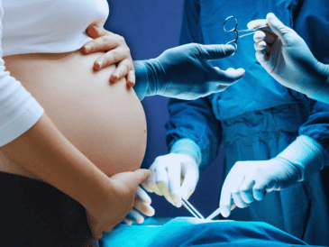 Descubre cómo la cesárea está provocando que los bebés nazcan antes de tiempo, con menor peso y talla, afectando su desarrollo óptimo desde el primer día. EL INFORMADOR / ARCHIVO