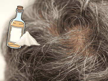 Para quienes buscan tratar las canas de forma más efectiva, especialistas recomiendan acudir con dermatólogos o profesionales capilares antes de probar tratamientos virales que podrían afectar la salud del cuero cabelludo. CANVA
