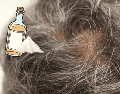 Para quienes buscan tratar las canas de forma más efectiva, especialistas recomiendan acudir con dermatólogos o profesionales capilares antes de probar tratamientos virales que podrían afectar la salud del cuero cabelludo. CANVA