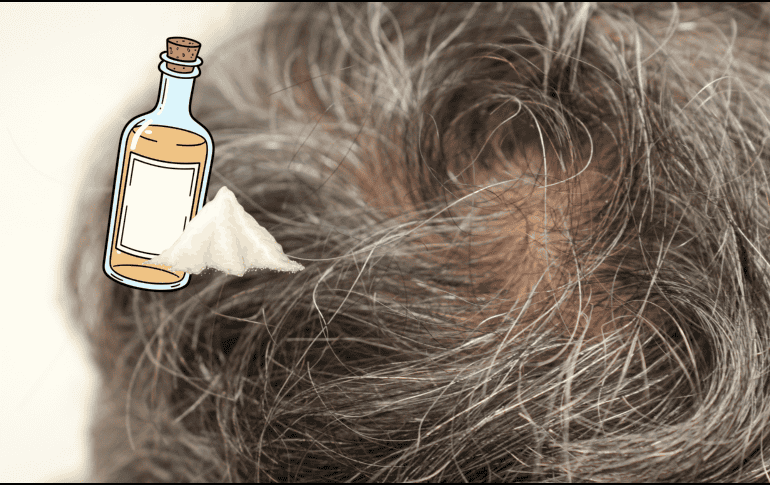 Para quienes buscan tratar las canas de forma más efectiva, especialistas recomiendan acudir con dermatólogos o profesionales capilares antes de probar tratamientos virales que podrían afectar la salud del cuero cabelludo. CANVA