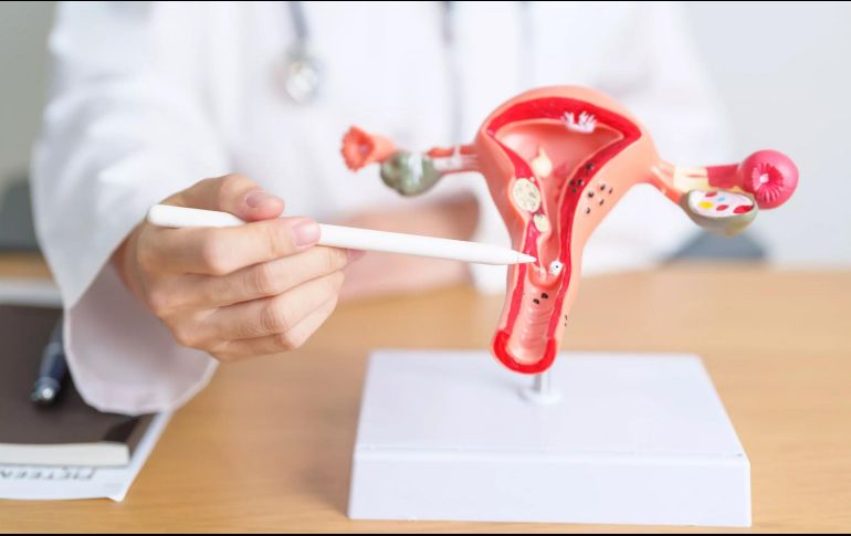 Esta anomalía fisiológica impide que los ovarios liberen óvulos de forma regular y predecible, afectando directamente la fertilidad, la planificación familiar y el ciclo natural del cuerpo femenino. ESPECIAL