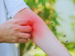 Las altas temperaturas primaverales acortan drásticamente el ciclo reproductivo del temido mosquito Aedes aegypti, el cual es el principal vector de enfermedades virales que afectan a la población mexicana cada año. ESPECIAL / CANVA