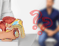 El tacto rectal es una exploración física en la que un médico introduce un dedo enguantado y lubricado en el recto para evaluar el tamaño, la forma y la textura de la próstata.  CANVA