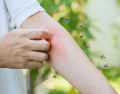 La respuesta tiene que ver con una combinación de factores biológicos, químicos y ambientales que hacen que ciertos individuos sean más fáciles de detectar para especies como Aedes aegypti, uno de los mosquitos más estudiados por la comunidad científica. CANVA