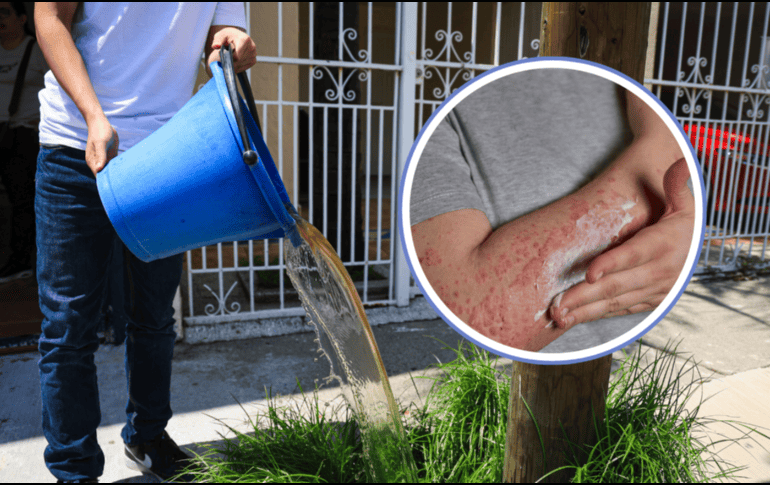 El funcionario cuestionó las evidencias de vecinos y organizaciones, quienes aseguran que tras bañarse y utilizar el agua contaminada que llega a sus viviendas han presentado enfermedades. EL INFORMADOR / ARCHIVO / FREEPIK / CANVA