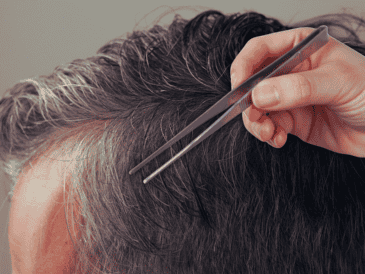 La extracción mecánica y repetida puede inflamar de manera severa esta delicada estructura anatómica, alterando su funcionamiento normal. ESPECIAL / CANVA