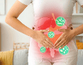 La enfermedad puede confundirse fácilmente con una gastroenteritis o una intoxicación alimentaria común, ya que comparte síntomas como diarrea, dolor abdominal y náuseas. CANVA