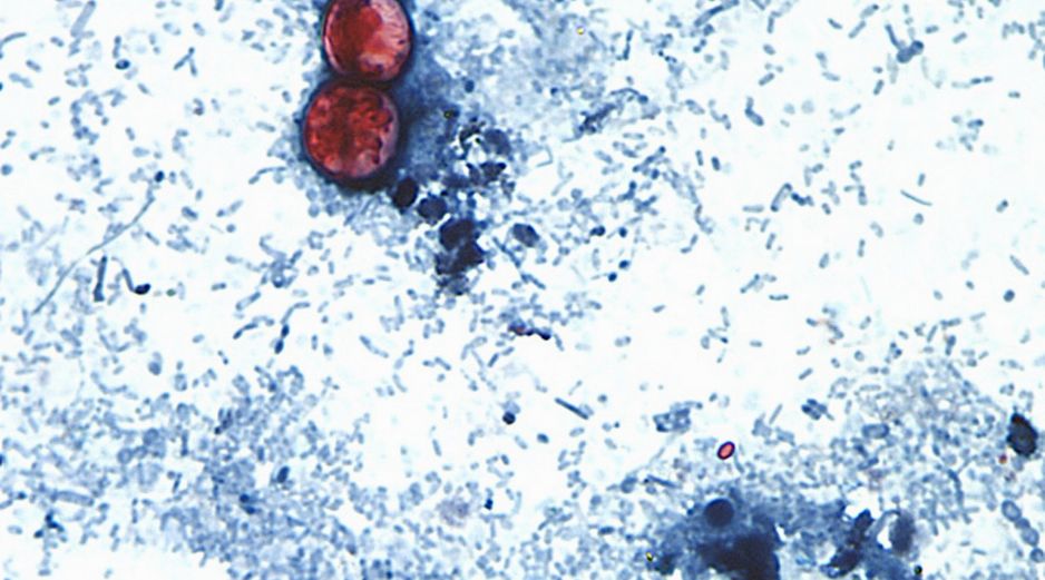 Esta fotografía tomada a través de un microscopio y difundida por los CDC muestra Cyclospora cayetanensis oocysts de una muestra de heces. AP/ARCHIVO
