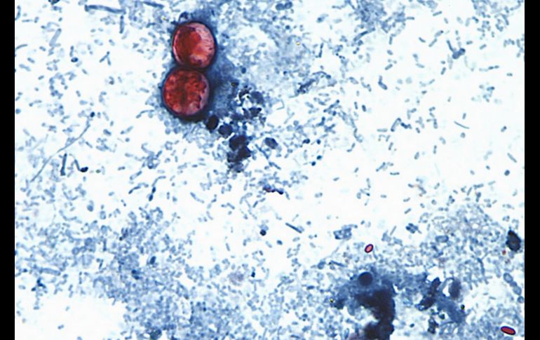 Esta fotografía tomada a través de un microscopio y difundida por los CDC muestra Cyclospora cayetanensis oocysts de una muestra de heces. AP/ARCHIVO