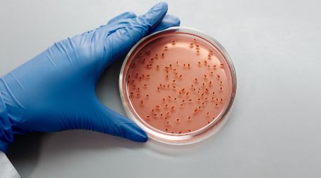 La cyclospora es un parásito microscópico que comúnmente causa diarrea y cuyos brotes ocurren a finales de la primavera y durante el verano. ESPECIAL/PEXELS