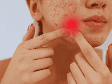 Mantener las manos alejadas del rostro sigue siendo la regla de oro indiscutible del cuidado facial. ESPECIAL / CANVA