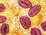 El Hospital General de México indicó que la investigación epidemiológica y sanitaria continúa para determinar la fuente específica de contaminación. UNSPLASH