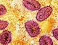 El Hospital General de México indicó que la investigación epidemiológica y sanitaria continúa para determinar la fuente específica de contaminación. UNSPLASH
