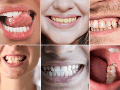 Mantener una buena higiene oral, acudir a revisiones periódicas y prestar atención a cualquier cambio visible sigue siendo la mejor estrategia para prevenir complicaciones y conservar una sonrisa saludable. CANVA