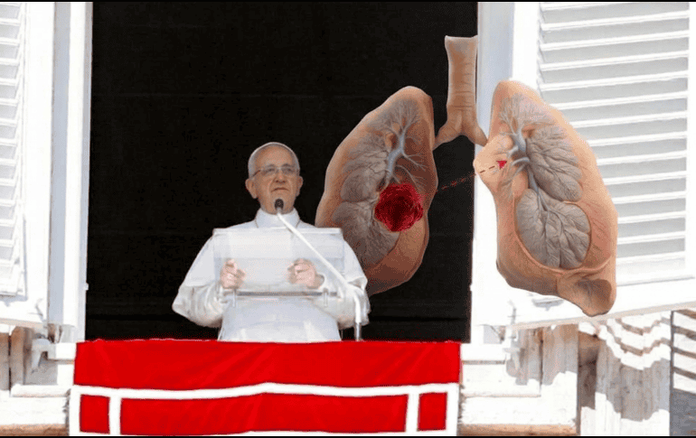 León XIV reveló su padecimiento durante su oración del mediodía del pasado domingo 11 de octubre. EFE / ARCHIVO / UNSPLASH / A. Dhage